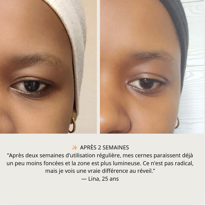 Patchs anti-cernes pigmentées