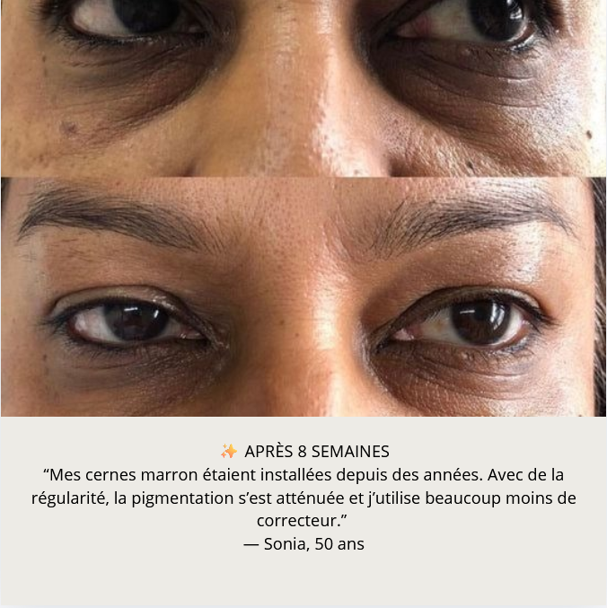 Patchs anti-cernes pigmentées